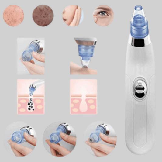 Cell-Operated Blackhead Vacuum: Refresh Your Skin