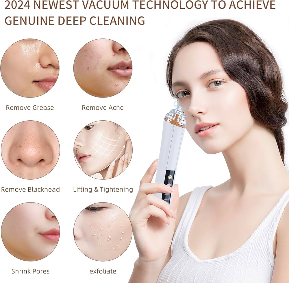 Cell-Operated Blackhead Vacuum: Refresh Your Skin