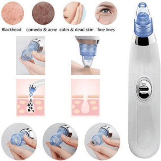 Cell-Operated Blackhead Vacuum: Refresh Your Skin